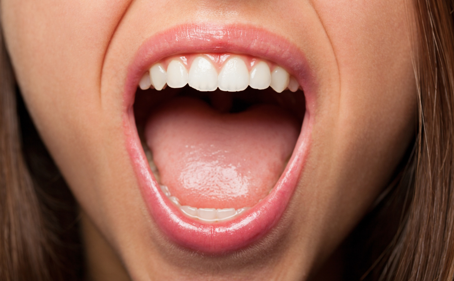 Segundo o especialista em implantodontia Dr. Bruno Segnini, trata-se de um problema que afeta os lábios e estruturas da boca como gengivas, bochechas, céu da boca e a língua