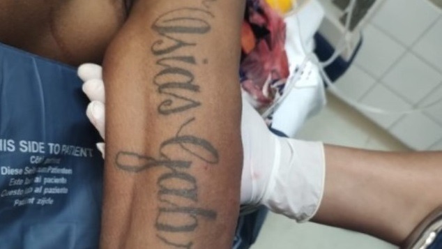 Morre ciclista ferido em acidente na Via Expressa; vítima estava internada na Santa Casa