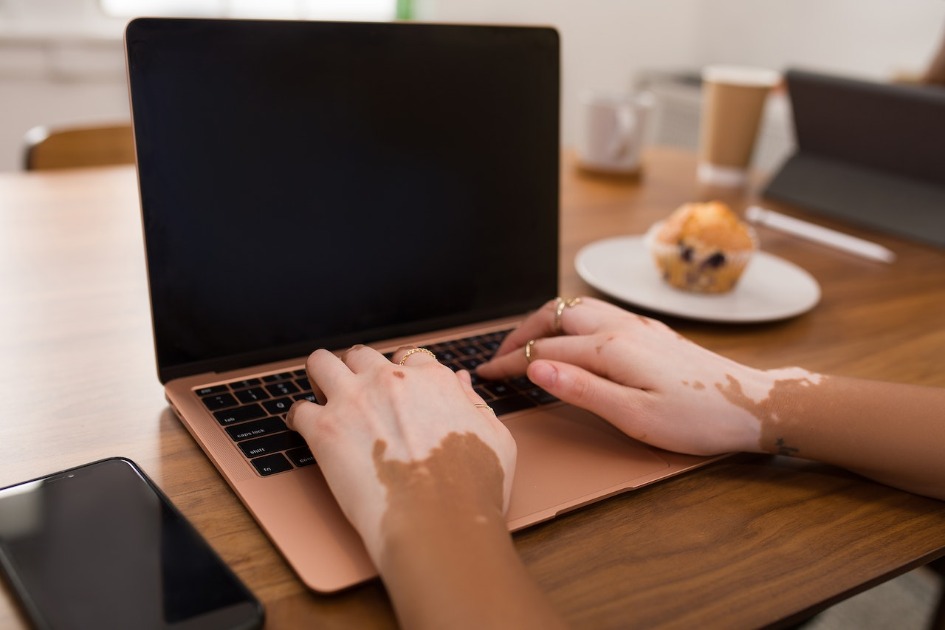 PAT de Araraquara tem vaga home office; veja as oportunidades