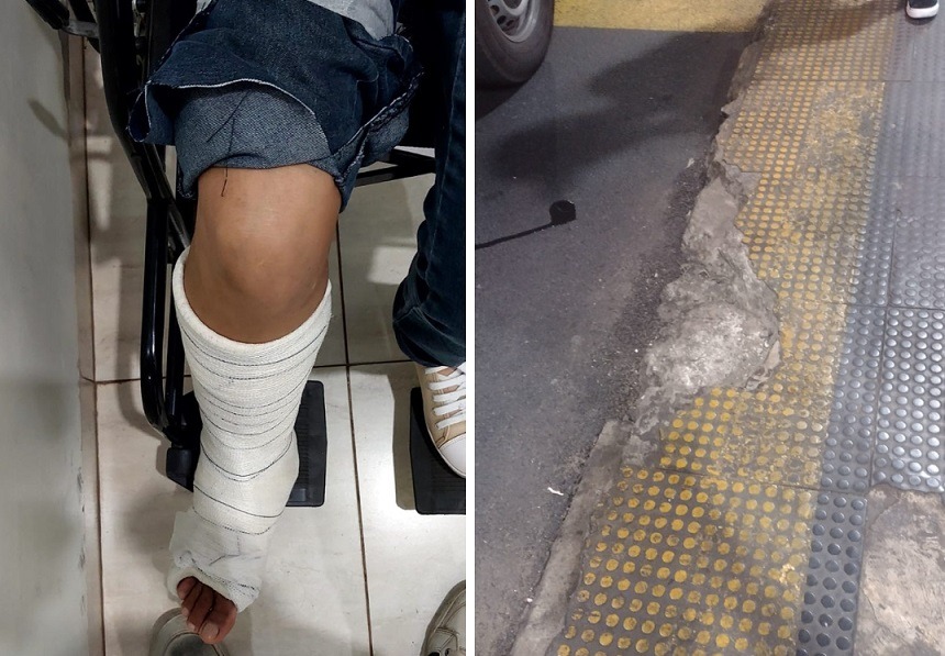 Moradora cai ao descer de ônibus no TCI em Araraquara; ‘plataforma tinha buraco que mais parecia CRATERA’