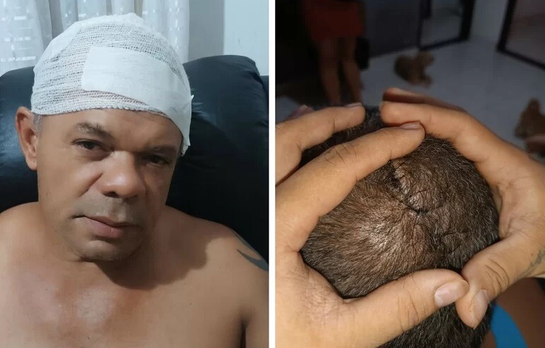 Filha inicia campanha para ajudar pai com diagnóstico de câncer com metástase; veja como ajudar