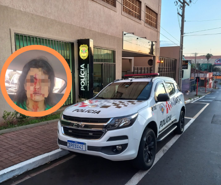 Indignada: mulher é agredida após discussão de trânsito em Araraquara; ‘me perseguiu’