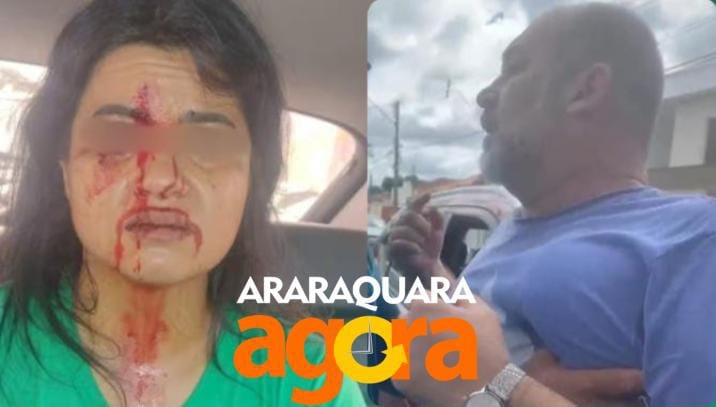 'Me perseguiu e me deu vários socos' diz mulher que foi agredida no trânsito em Araraquara