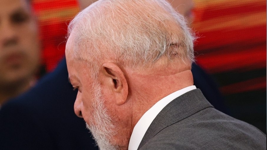 Lula passa por cirurgia de emergência após hemorragia craniana