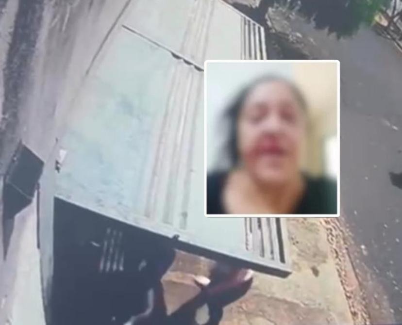 VÍDEO: Idosa fica ferida após ser agredida pela ex-nora na frente do neto de 6 anos no Jardim Universal