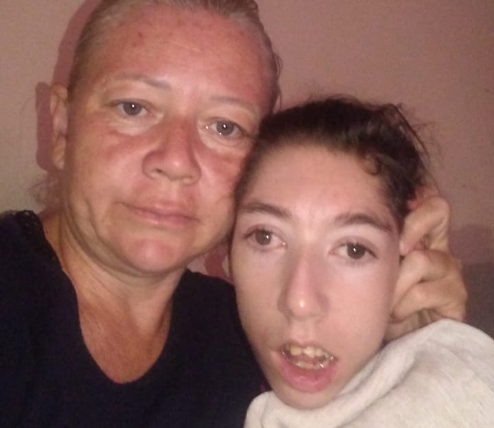 Mãe luta para manter suplemento alimentar da filha com síndrome rara e pede ajuda