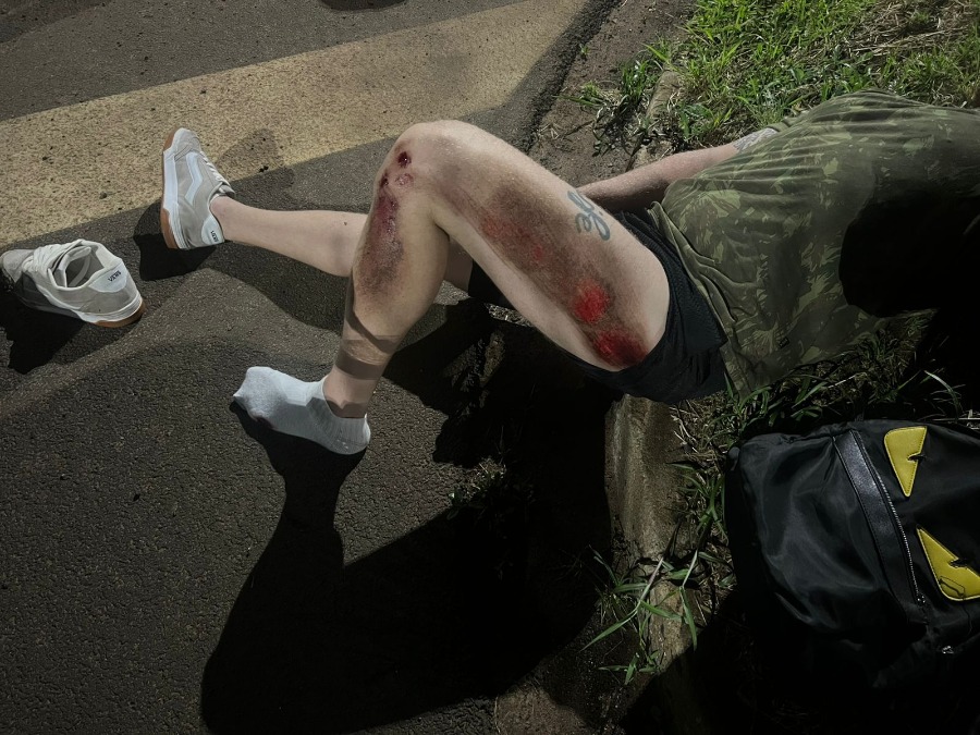 Buraco na via provoca acidente e deixa motociclista com ferimentos graves em Araraquara