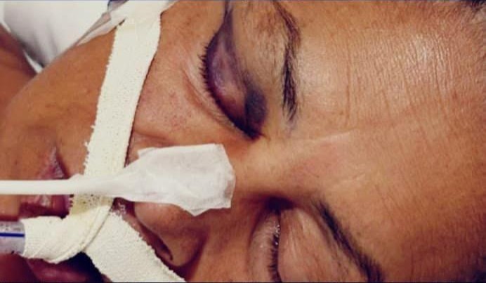 Mulher fica gravemente ferida após ser agredida tentando separar briga de casal em Boa Esperança do Sul