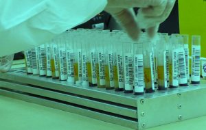 Fundação Pró-Sangue envia plasma convalescente para Araraquara