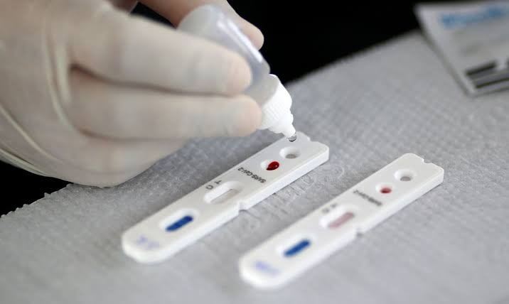 Testagem em comércio e indústria confirma 6 casos e fecha uma empresa