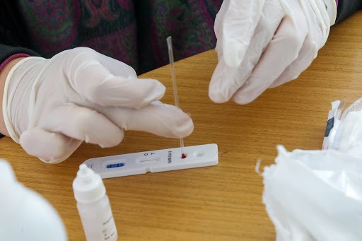 Mais 269 testes são aplicados em 17 estabelecimentos de Araraquara