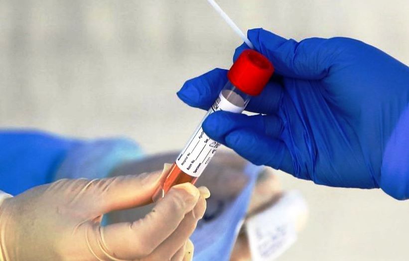 Prefeitura quer que Unesp faça 180 testes por dia de coronavírus