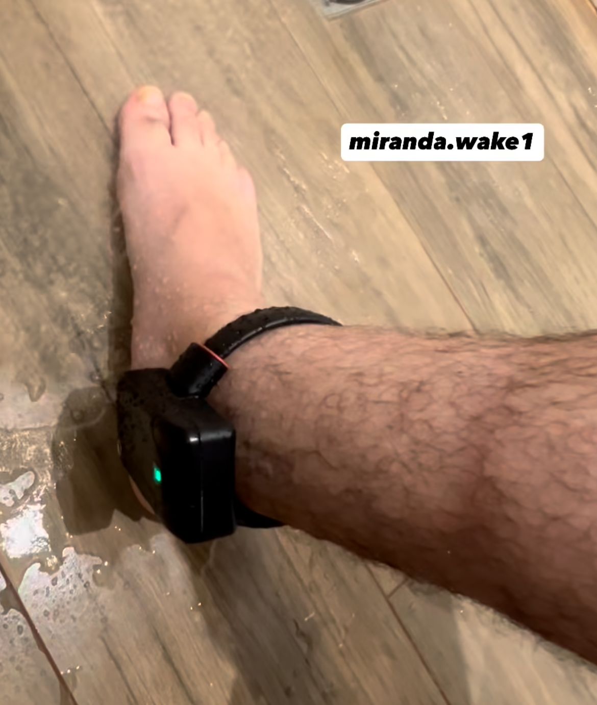 Foto: Redes Sociais/Willian Mostrando Como Faz Pra Tomar Banho Com A Tornozeleira