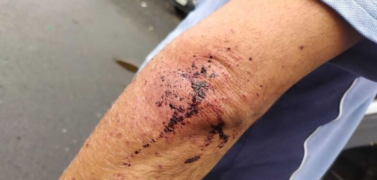  A vítima ficou ferida no braço, por conta dos estilhaços do vidro