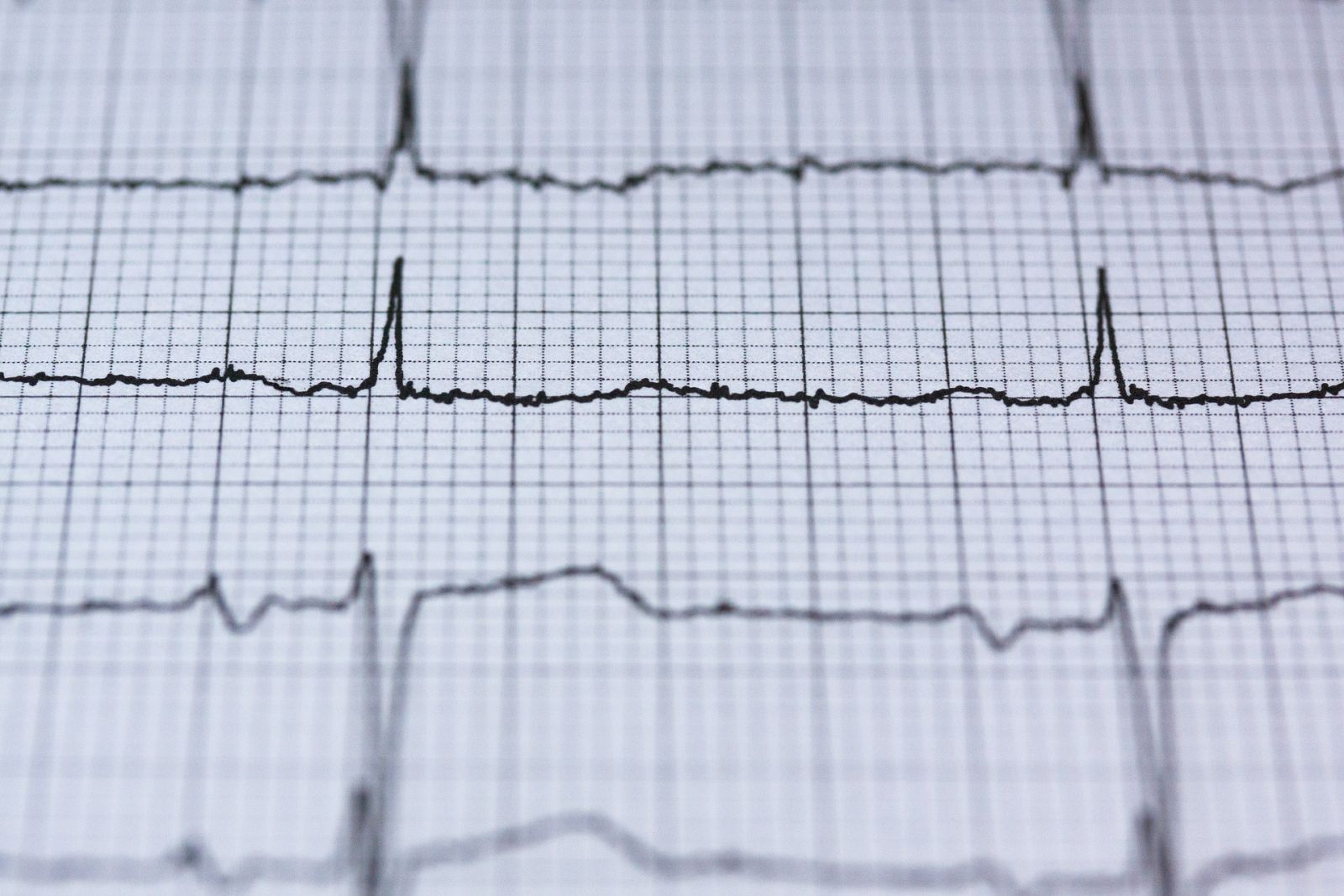 O cardiologista, porém, alerta que até mesmo esses eventos podem causar disfunções recorrentes no sistema cardiovascular