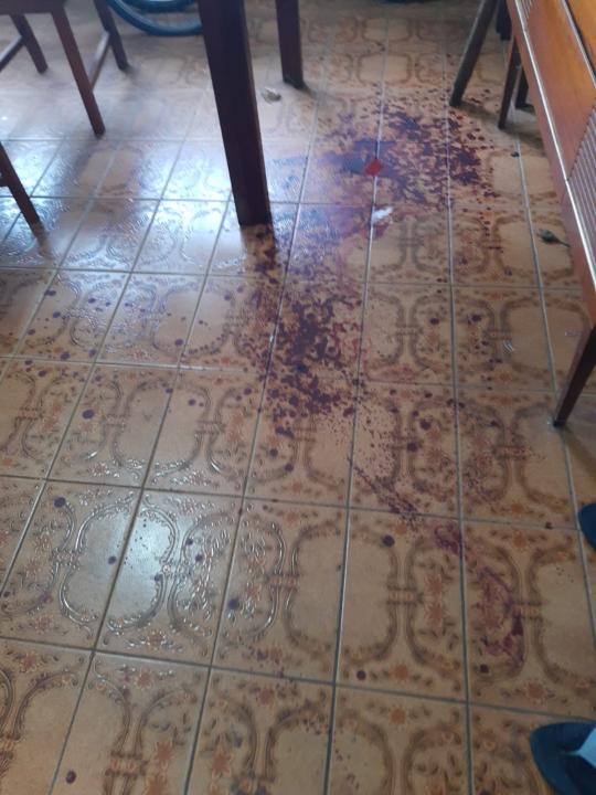 Foto 4 de 8 — Comerciantes são esfaqueados em tentativa de assalto na Vila Xavier